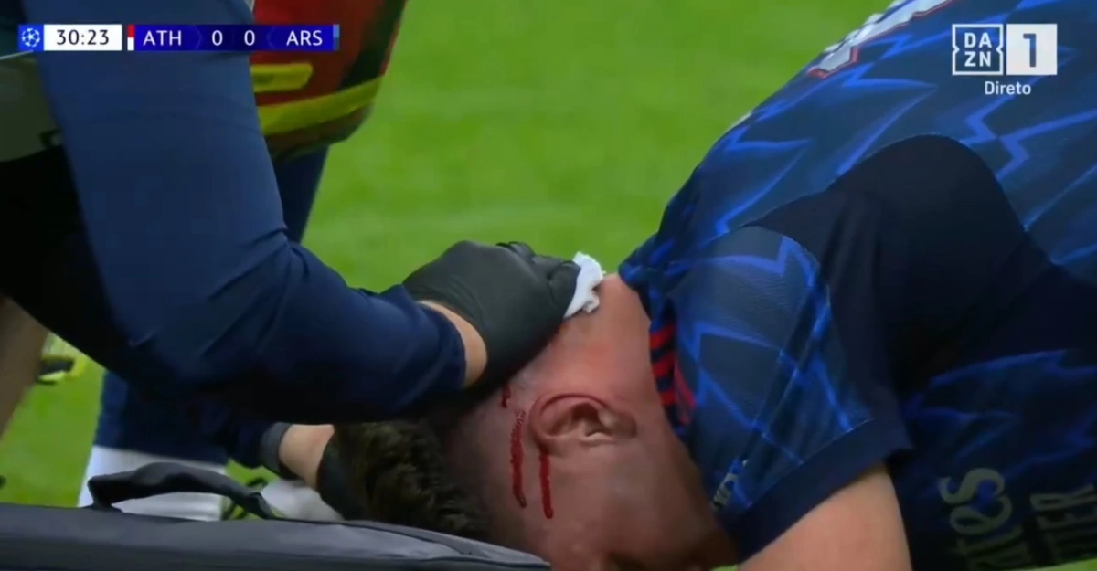 Imagem de contexto do artigo Vídeo: Gyokeres ficou neste estado após choque de cabeças em Bilbau