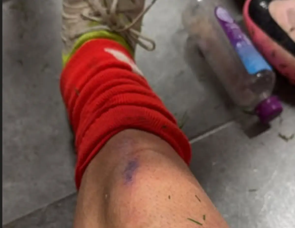 Imagem de contexto do artigo Amdouni deixou o jogo entre Farense e Benfica com marcas numa perna