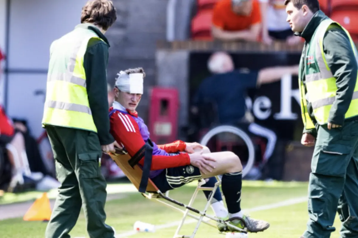 Imagem de contexto do artigo Adepto escocês condenado a prisão por desfigurar jogador com uma cadeira