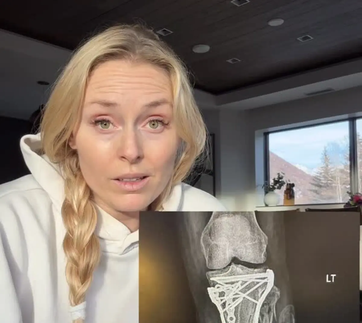 Lindsey Vonn mostra-se fora do hospital