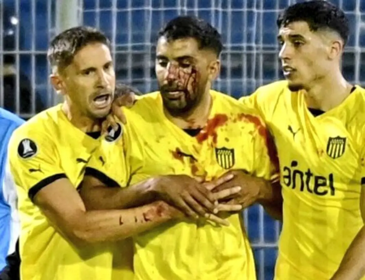 Imagem de contexto do artigo Di María atento: adepto do Rosario Central deixa jogador do Peñarol a sangrar abundantemente