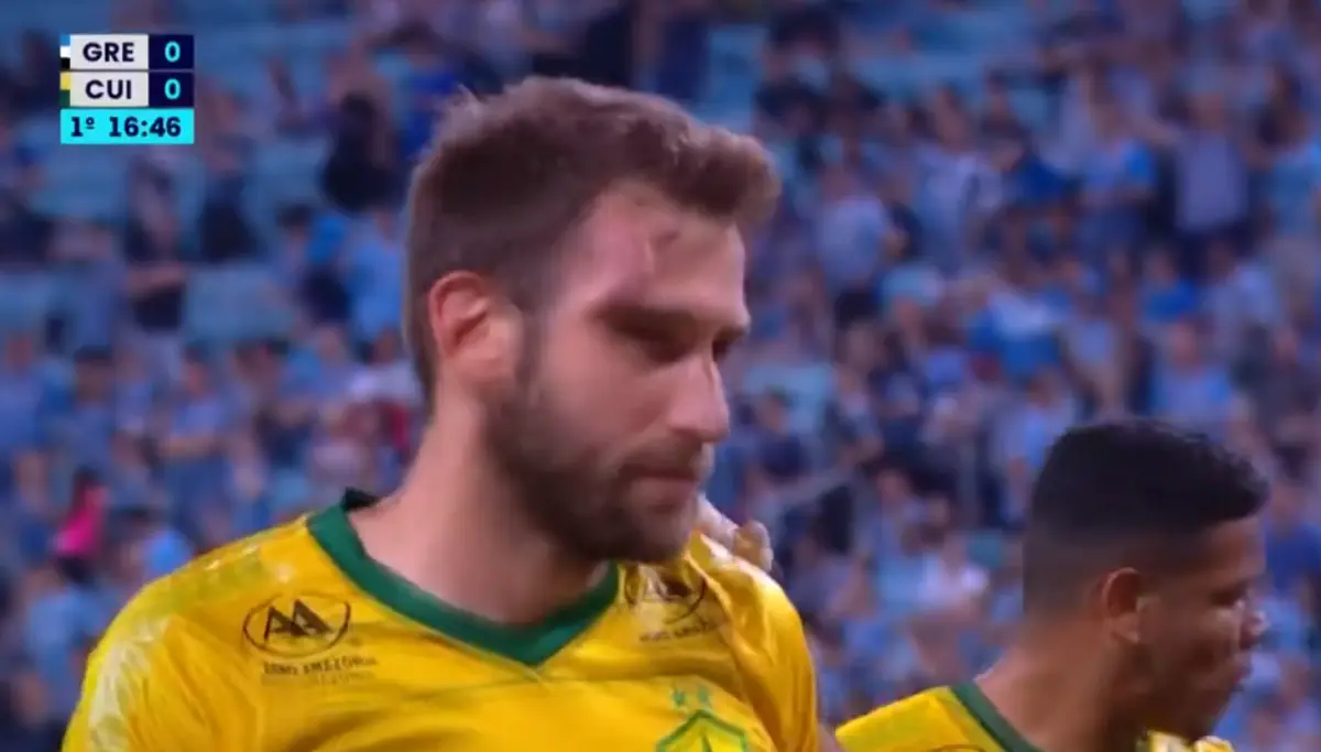 Imagem de contexto do artigo Até arrepia: jogador do Cuiabá ficou com "galo" após choque de cabeças