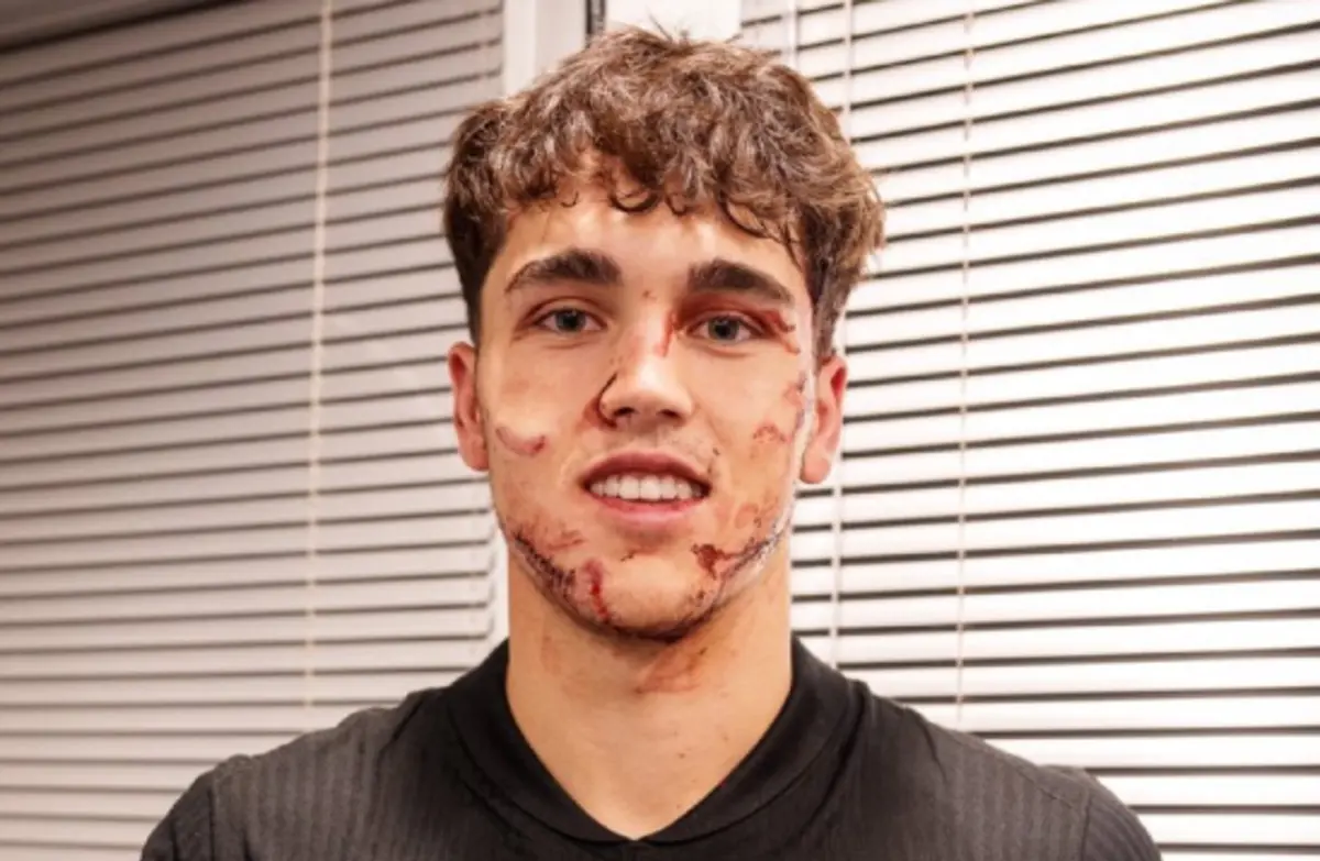 Imagem de contexto do artigo Cubarsí deixou o Estrela Vermelha-Barcelona com a cara neste estado