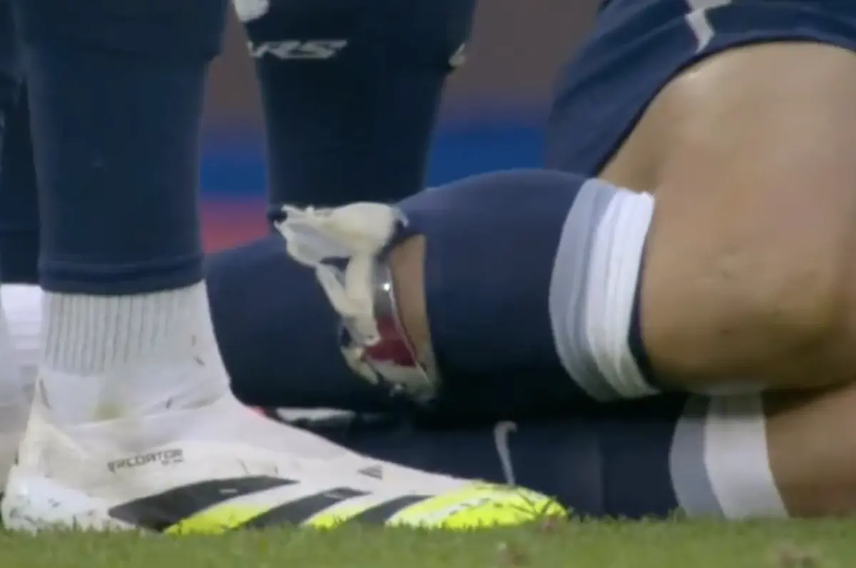 Imagem de contexto do artigo Palhinha sofreu falta dura... e a meia que o diga. Veja como ficou