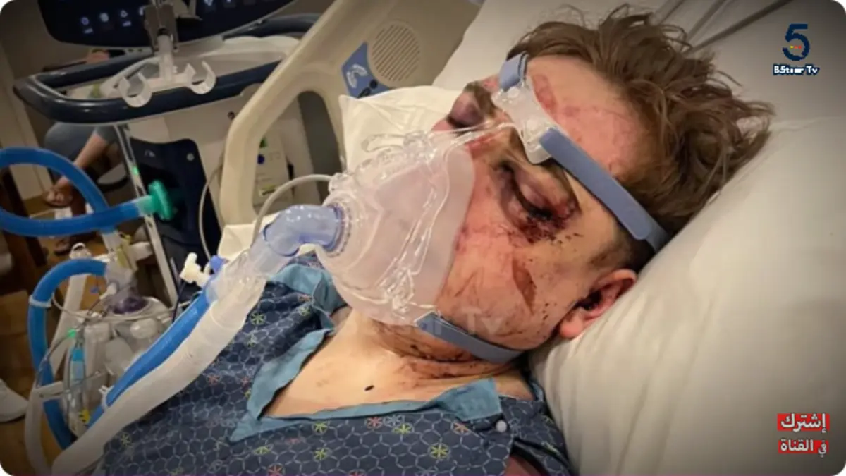 Imagem de contexto do artigo Promessa do motocross morre após ser atropelado depois de uma queda