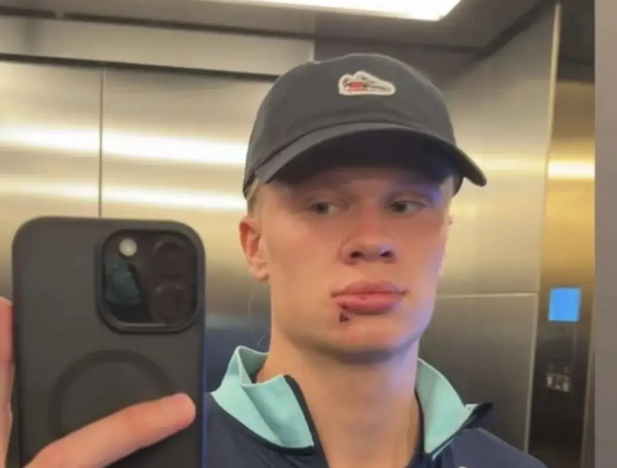 Imagem de contexto do artigo Haaland suturado no lábio após levar com a porta do autocarro da seleção