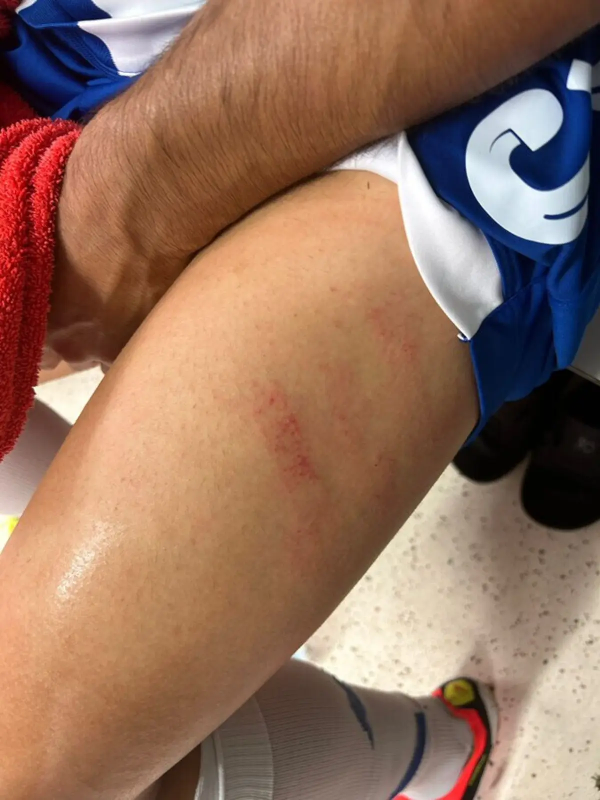 Imagem de contexto do artigo FC Porto mostra coxa do defesa Gabriel Brás: "VAR não quis ver. Se viu e não sinalizou, é demasiado incompetente"