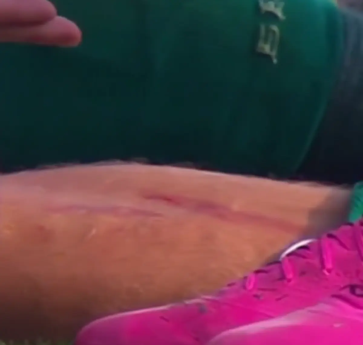 Imagem de contexto do artigo Expulsão perdoada? Erick Pulgar deixou a perna de Bruno Fuchs assim no Palmeiras-Flamengo