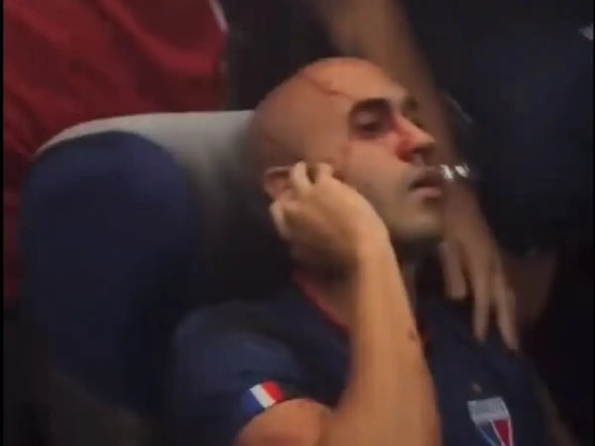 Jogador do Fortaleza ferido (créditos: X/Reprodução)