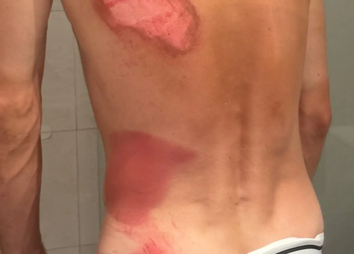 Imagem de contexto do artigo Ivo Oliveira ficou em péssimo estado após queda, mas sagrou-se campeão de fundo