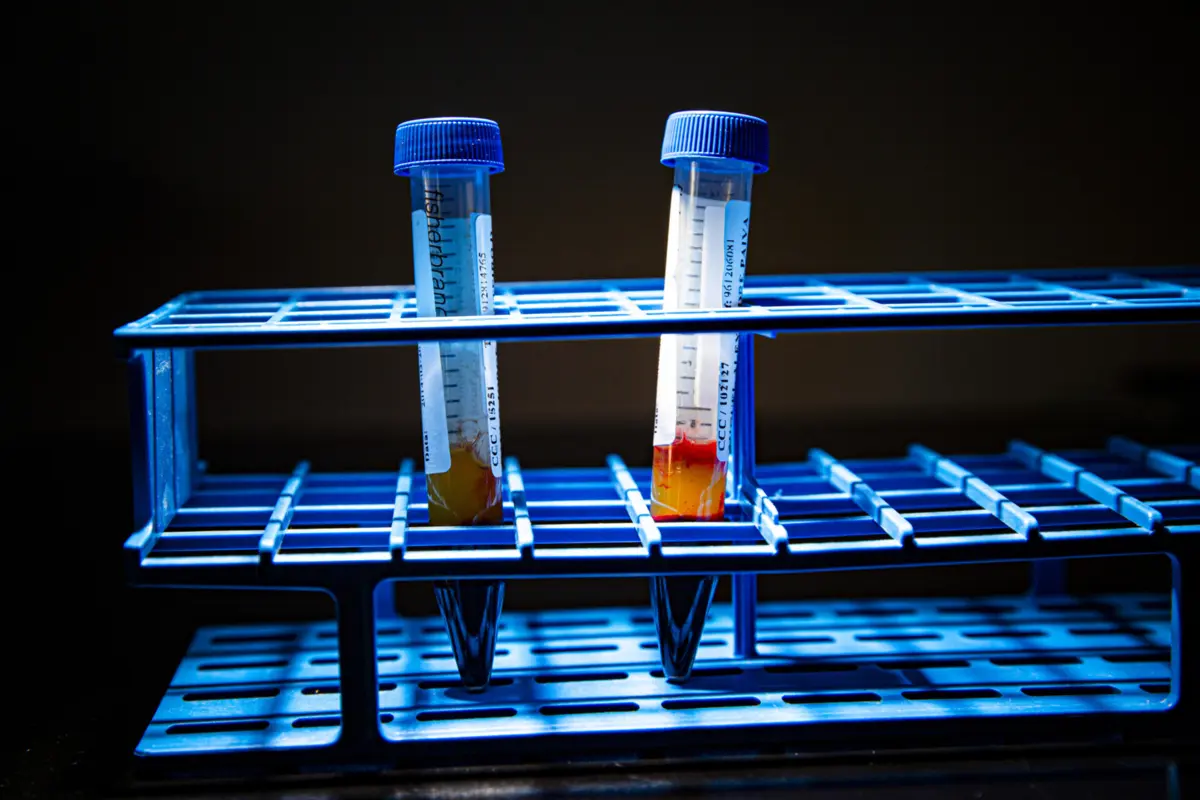 Imagem de contexto do artigo Fundação Champalimaud participa em estudo europeu sobre terapia psicadélica